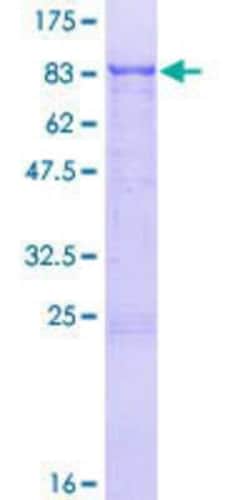 Novus Biologicals&trade;&nbsp;Recombinant Human ZNF192 GST (N-Term) Protein
