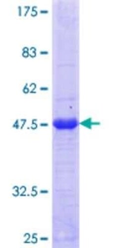 Novus Biologicals Recombinant Human ZNF192 GST (N-Term) Protein 10 &mu;g | Buy Online | Novus Biologicals&trade; | Fisher Scientific