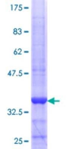 Novus Biologicals Recombinant Human ZNF193 GST (N-Term) Protein 10 &mu;g | Buy Online | Novus Biologicals&trade; | Fisher Scientific