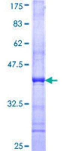 Novus Biologicals Recombinant Human ZFP200 GST (N-Term) Protein 10 &mu;g | Buy Online | Novus Biologicals&trade; | Fisher Scientific