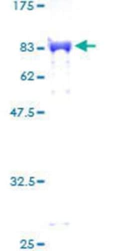 Novus Biologicals Recombinant Human ZNF207 GST (N-Term) Protein 25 &mu;g | Buy Online | Novus Biologicals&trade; | Fisher Scientific