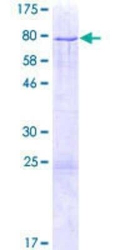 Novus Biologicals Recombinant Human ZNF213 GST (N-Term) Protein 2 &mu;g | Buy Online | Novus Biologicals&trade; | Fisher Scientific