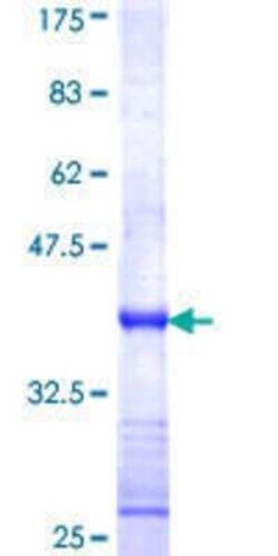 Novus Biologicals Recombinant Human ZNF214 GST (N-Term) Protein 25 &mu;g | Buy Online | Novus Biologicals&trade; | Fisher Scientific