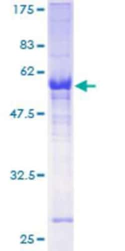 Novus Biologicals Recombinant Human ZNF215 GST (N-Term) Protein 10 &mu;g | Buy Online | Novus Biologicals&trade; | Fisher Scientific