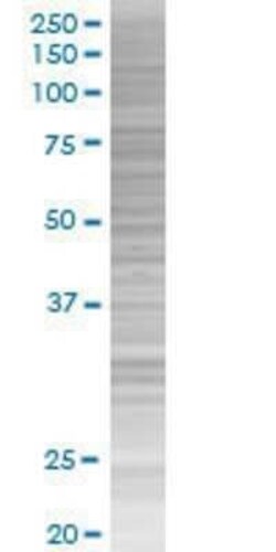 Novus Biologicals ZNF224 293T Cell Transient Overexpression Lysate 0.1 mL | Buy Online | Novus Biologicals&trade; | Fisher Scientific