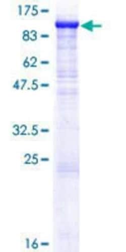 Novus Biologicals Recombinant Human ZP2 GST (N-Term) Protein 10 &mu;g | Buy Online | Novus Biologicals&trade; | Fisher Scientific