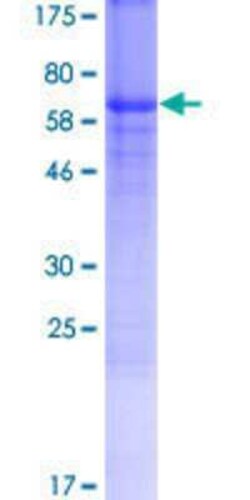 Novus Biologicals Recombinant Human ZP3 GST (N-Term) Protein 10 &mu;g | Buy Online | Novus Biologicals&trade; | Fisher Scientific