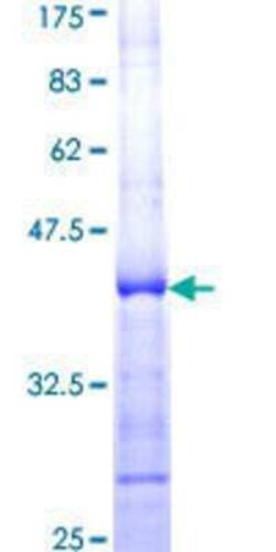 Novus Biologicals Recombinant Human RIZ1 GST (N-Term) Protein 25 &mu;g | Buy Online | Novus Biologicals&trade; | Fisher Scientific