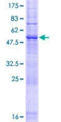Novus Biologicals Recombinant Human LAPTM5 GST (N-Term) Protein 10 &mu;g | Buy Online | Novus Biologicals&trade; | Fisher Scientific