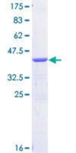 Novus Biologicals Recombinant Human CSDE1 GST (N-Term) Protein 10 &mu;g:Proteínas