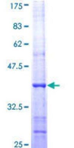 Novus Biologicals Recombinant Human BTG2 GST (N-Term) Protein 25 &mu;g | Buy Online | Novus Biologicals&trade; | Fisher Scientific