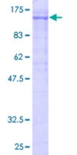 Novus Biologicals Recombinant Human KF1 GST (N-Term) Protein 10 &mu;g | Buy Online | Novus Biologicals&trade; | Fisher Scientific