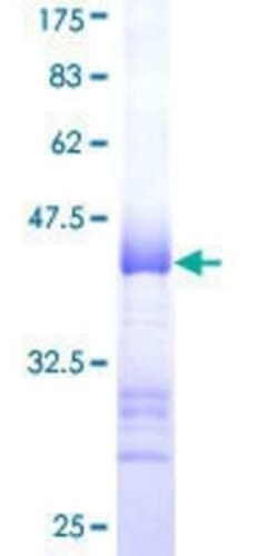 Novus Biologicals Recombinant Human KF1 GST (N-Term) Protein 25 &mu;g | Buy Online | Novus Biologicals&trade; | Fisher Scientific