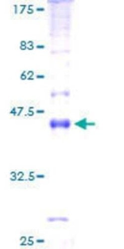 Novus Biologicals Recombinant Human MALL GST (N-Term) Protein 2 &mu;g | Buy Online | Novus Biologicals&trade; | Fisher Scientific
