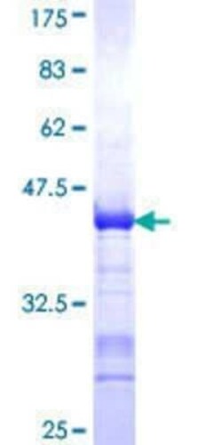 Novus Biologicals Recombinant Human Chromogranin C GST (N-Term) Protein 25 &mu;g | Buy Online | Novus Biologicals&trade; | Fisher Scientific