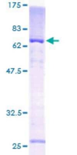 Novus Biologicals Recombinant Human KvBeta1 GST (N-Term) Protein 25 &mu;g | Buy Online | Novus Biologicals&trade; | Fisher Scientific