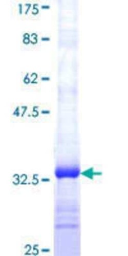Novus Biologicals Recombinant Human REEP5 GST (N-Term) Protein 10 &mu;g | Buy Online | Novus Biologicals&trade; | Fisher Scientific