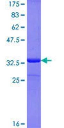 Novus Biologicals Recombinant Human BAT2 GST (N-Term) Protein 25 &mu;g | Buy Online | Novus Biologicals&trade; | Fisher Scientific