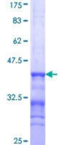 Novus Biologicals Recombinant Human BAT3/BAG6 GST (N-Term) Protein 10 &mu;g | Buy Online | Novus Biologicals&trade; | Fisher Scientific