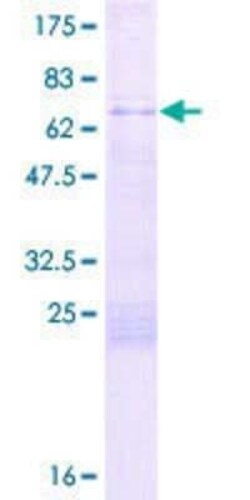 Novus Biologicals Recombinant Human GPANK1/BAT4 GST (N-Term) Protein 2 &mu;g | Buy Online | Novus Biologicals&trade; | Fisher Scientific