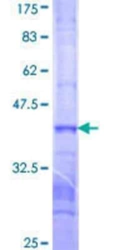 Novus Biologicals Recombinant Human GPANK1/BAT4 GST (N-Term) Protein 10 &mu;g | Buy Online | Novus Biologicals&trade; | Fisher Scientific