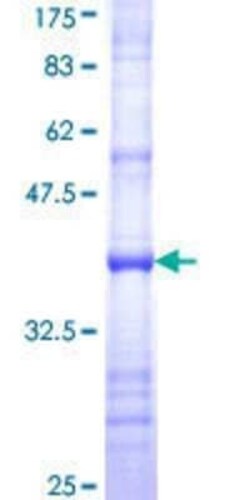 Novus Biologicals Recombinant Human BAT5 GST (N-Term) Protein 25 &mu;g | Buy Online | Novus Biologicals&trade; | Fisher Scientific