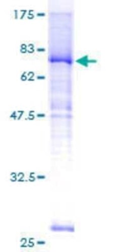 Novus Biologicals Recombinant Human SLC39A7/ZIP7 GST (N-Term) Protein 25 &mu;g | Buy Online | Novus Biologicals&trade; | Fisher Scientific