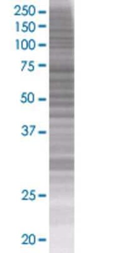 Novus Biologicals LST1 293T Cell Transient Overexpression Lysate 0.1 mL | Buy Online | Novus Biologicals&trade; | Fisher Scientific