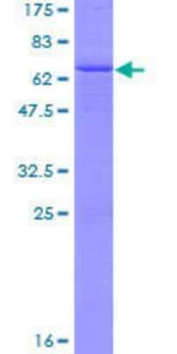 Novus Biologicals Recombinant Human Laforin/EPM2A GST (N-Term) Protein 10 &mu;g | Buy Online | Novus Biologicals&trade; | Fisher Scientific