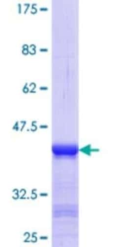 Novus Biologicals Recombinant Human AIMP2 GST (N-Term) Protein 25 &mu;g | Buy Online | Novus Biologicals&trade; | Fisher Scientific