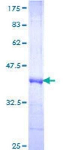 Novus Biologicals Recombinant Human Frizzled-3 GST (N-Term) Protein 25 &mu;g | Buy Online | Novus Biologicals&trade; | Fisher Scientific