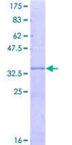 Novus Biologicals Recombinant Human TUSC3 GST (N-Term) Protein 10 &mu;g | Buy Online | Novus Biologicals&trade; | Fisher Scientific