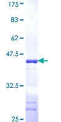 Novus Biologicals Recombinant Human UBXN8 GST (N-Term) Protein 10 &mu;g | Buy Online | Novus Biologicals&trade; | Fisher Scientific
