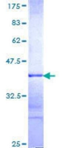 Novus Biologicals Recombinant Human MYST3 GST (N-Term) Protein 25 &mu;g | Buy Online | Novus Biologicals&trade; | Fisher Scientific