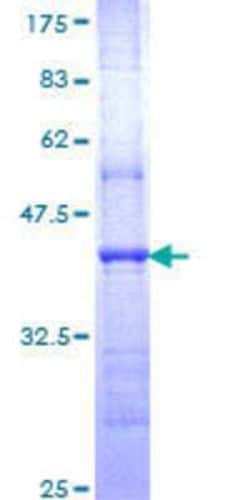 Novus Biologicals Recombinant Human NR4A3/NOR1 GST (N-Term) Protein 25 &mu;g | Buy Online | Novus Biologicals&trade; | Fisher Scientific