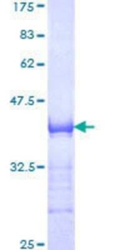 Novus Biologicals Recombinant Human AF10 GST (N-Term) Protein 10 &mu;g | Buy Online | Novus Biologicals&trade; | Fisher Scientific