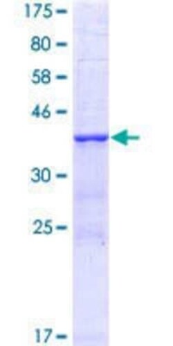 Novus Biologicals Recombinant Human NCOA4 GST (N-Term) Protein 25 &mu;g | Buy Online | Novus Biologicals&trade; | Fisher Scientific