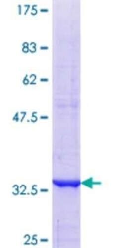 Novus Biologicals Recombinant Human GDC GST (N-Term) Protein 10 &mu;g | Buy Online | Novus Biologicals&trade; | Fisher Scientific