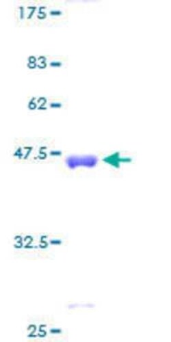 Novus Biologicals Recombinant Human CSRP3 GST (N-Term) Protein 2 &mu;g | Buy Online | Novus Biologicals&trade; | Fisher Scientific