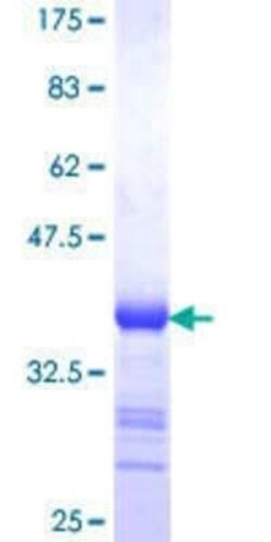 Novus Biologicals Recombinant Human CSRP3 GST (N-Term) Protein 25 &mu;g | Buy Online | Novus Biologicals&trade; | Fisher Scientific