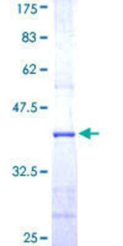 Novus Biologicals Recombinant Human Cullin 5 GST (N-Term) Protein 25 &mu;g | Buy Online | Novus Biologicals&trade; | Fisher Scientific
