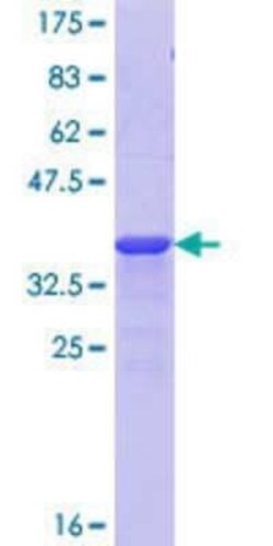 Novus Biologicals Recombinant Human KMT2D GST (N-Term) Protein 10 &mu;g | Buy Online | Novus Biologicals&trade; | Fisher Scientific