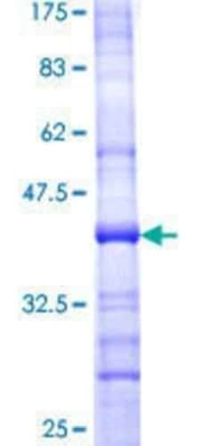 Novus Biologicals Recombinant Human AAAS GST (N-Term) Protein 10 &mu;g | Buy Online | Novus Biologicals&trade; | Fisher Scientific