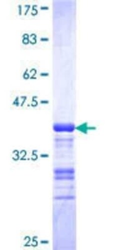 Novus Biologicals Recombinant Human CART1 GST (N-Term) Protein 10 &mu;g | Buy Online | Novus Biologicals&trade; | Fisher Scientific