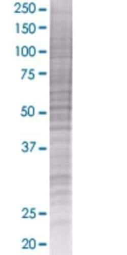 Novus Biologicals ST8 alpha-2,8-Sialyltransferase 8B/ST8SIA2 293T Cell Transient Overexpression Lysate 0.1 mL | Buy Online | Novus Biologicals&trade; | Fisher Scientific