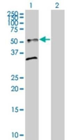 Novus Biologicals ST8 alpha-2,8-Sialyltransferase 8B/ST8SIA2 293T Cell Transient Overexpression Lysate 0.1 mL | Buy Online | Novus Biologicals&trade; | Fisher Scientific