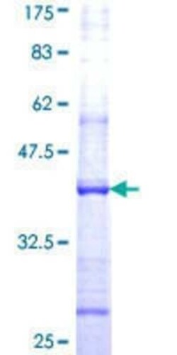 Novus Biologicals Recombinant Human NPRL3 GST (N-Term) Protein 10 &mu;g | Buy Online | Novus Biologicals&trade; | Fisher Scientific