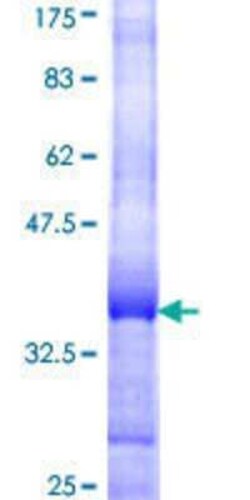 Novus Biologicals Recombinant Human Gigaxonin GST (N-Term) Protein 10 &mu;g | Buy Online | Novus Biologicals&trade; | Fisher Scientific