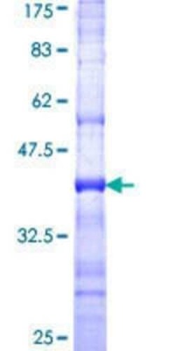 Novus Biologicals Recombinant Human AKAP1 GST (N-Term) Protein 25 &mu;g | Buy Online | Novus Biologicals&trade; | Fisher Scientific