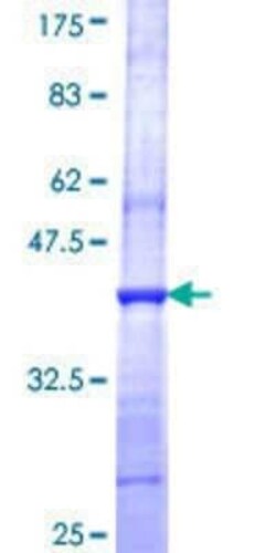 Novus Biologicals Recombinant Human SF3A2 GST (N-Term) Protein 2 &mu;g | Buy Online | Novus Biologicals&trade; | Fisher Scientific